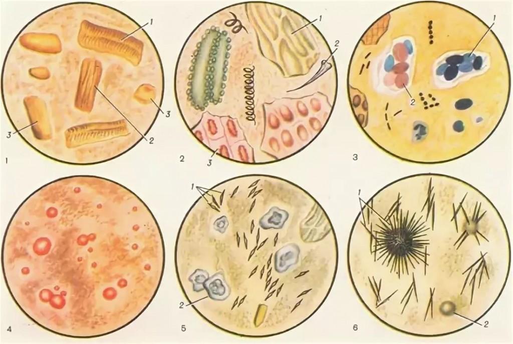 Кал под микроскопом фото копрограмма