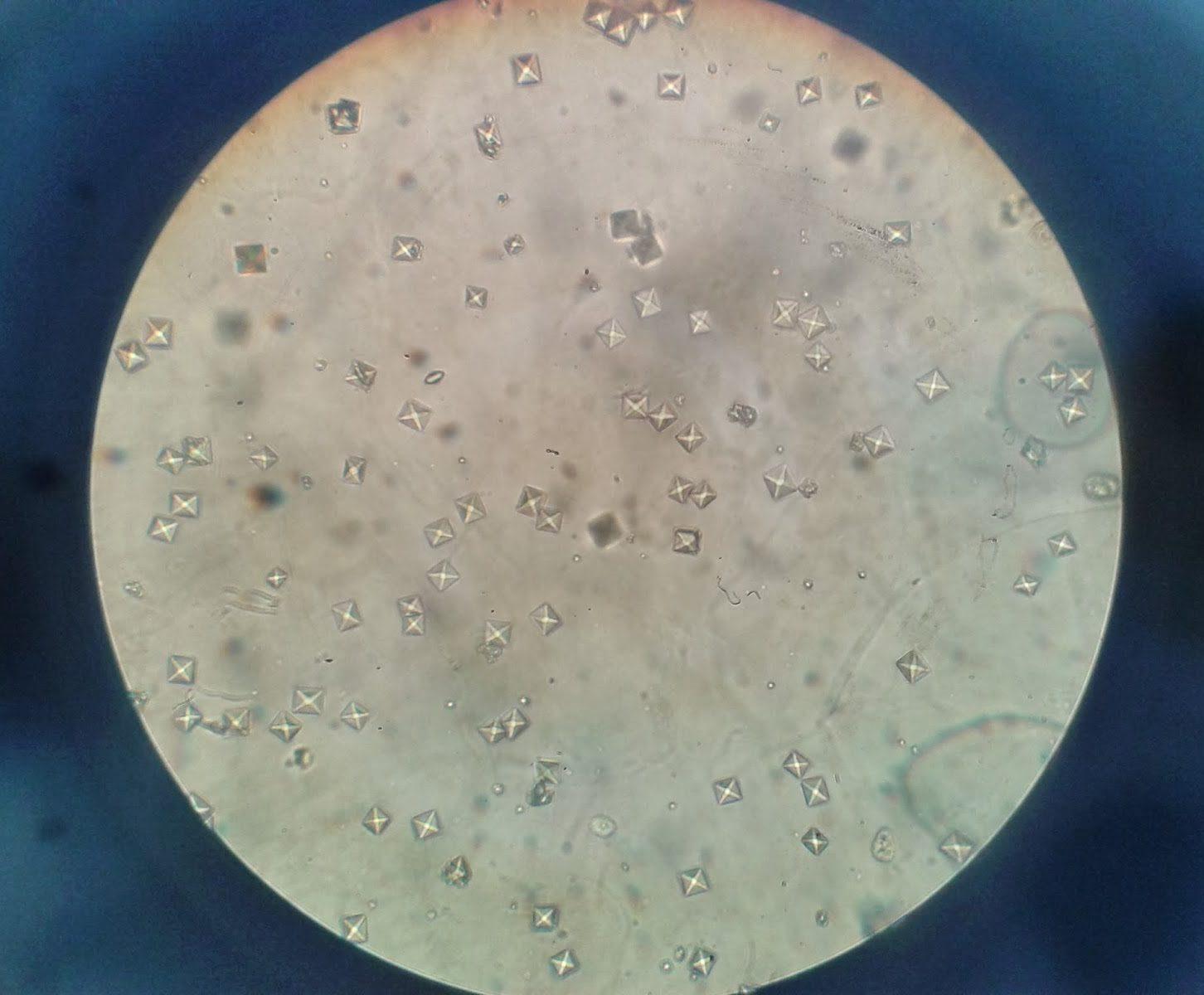 Кристаллы оксалата кальция под микроскопом
