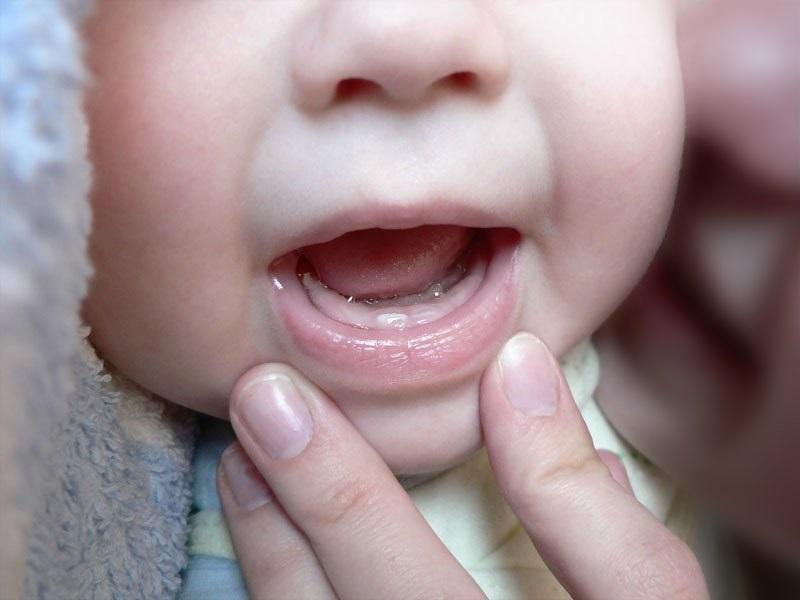 Первый долгожданный зубик у младенца
