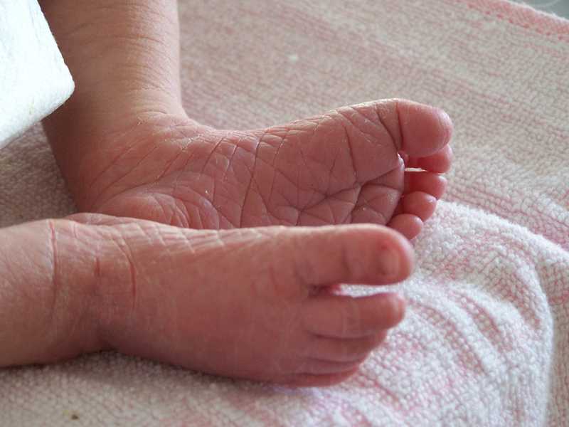У младенца очень сухая кожа на ножках