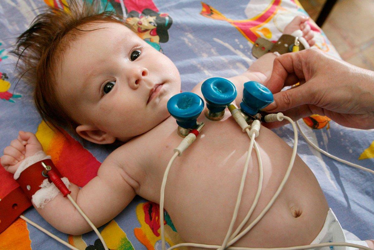 Электрокардиография новорожденного