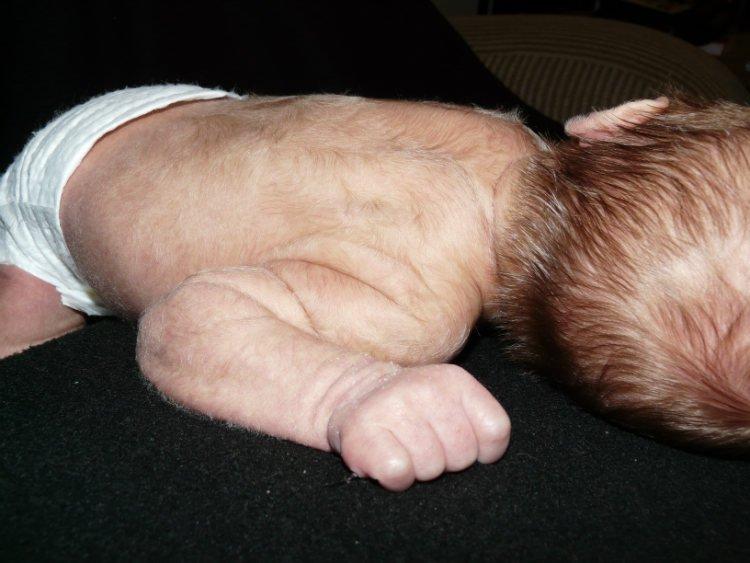 Новорожденный ребенок с волосками на теле