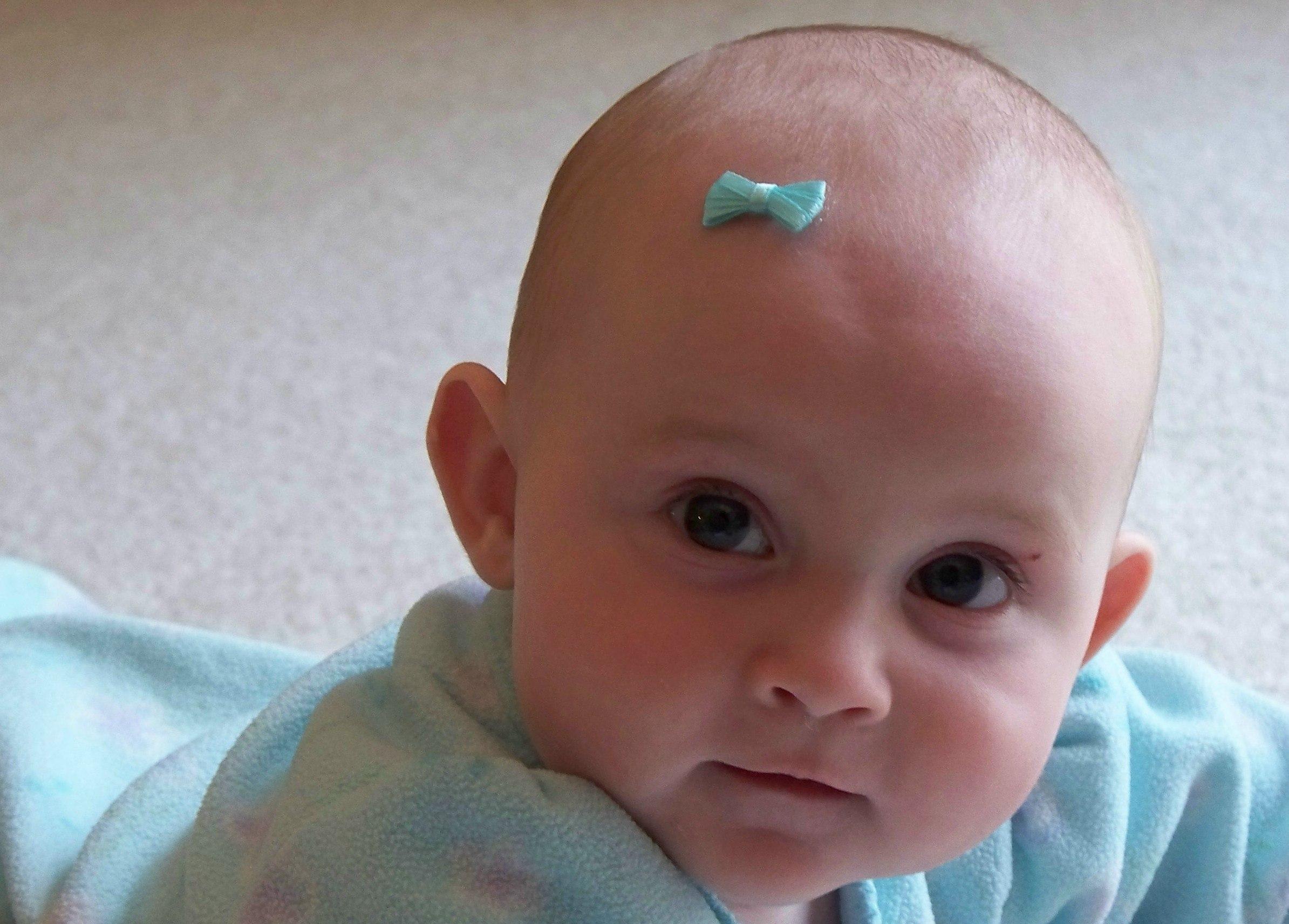 Выпадение волосков у малыша – естественный процесс