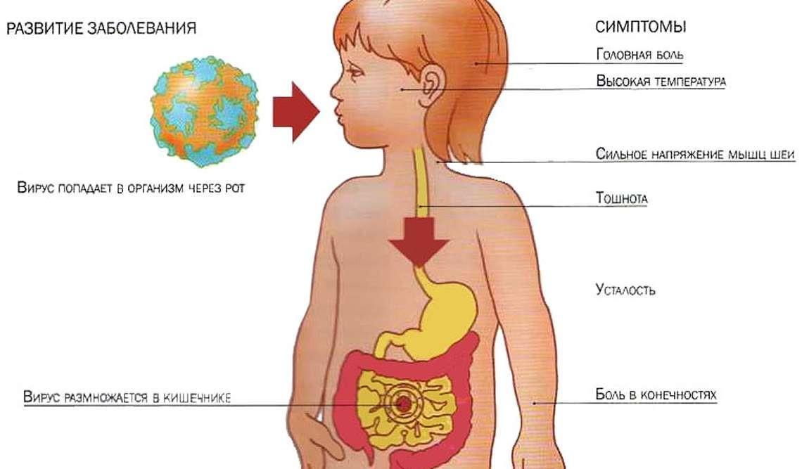 Этапы развития ротавирусной инфекции