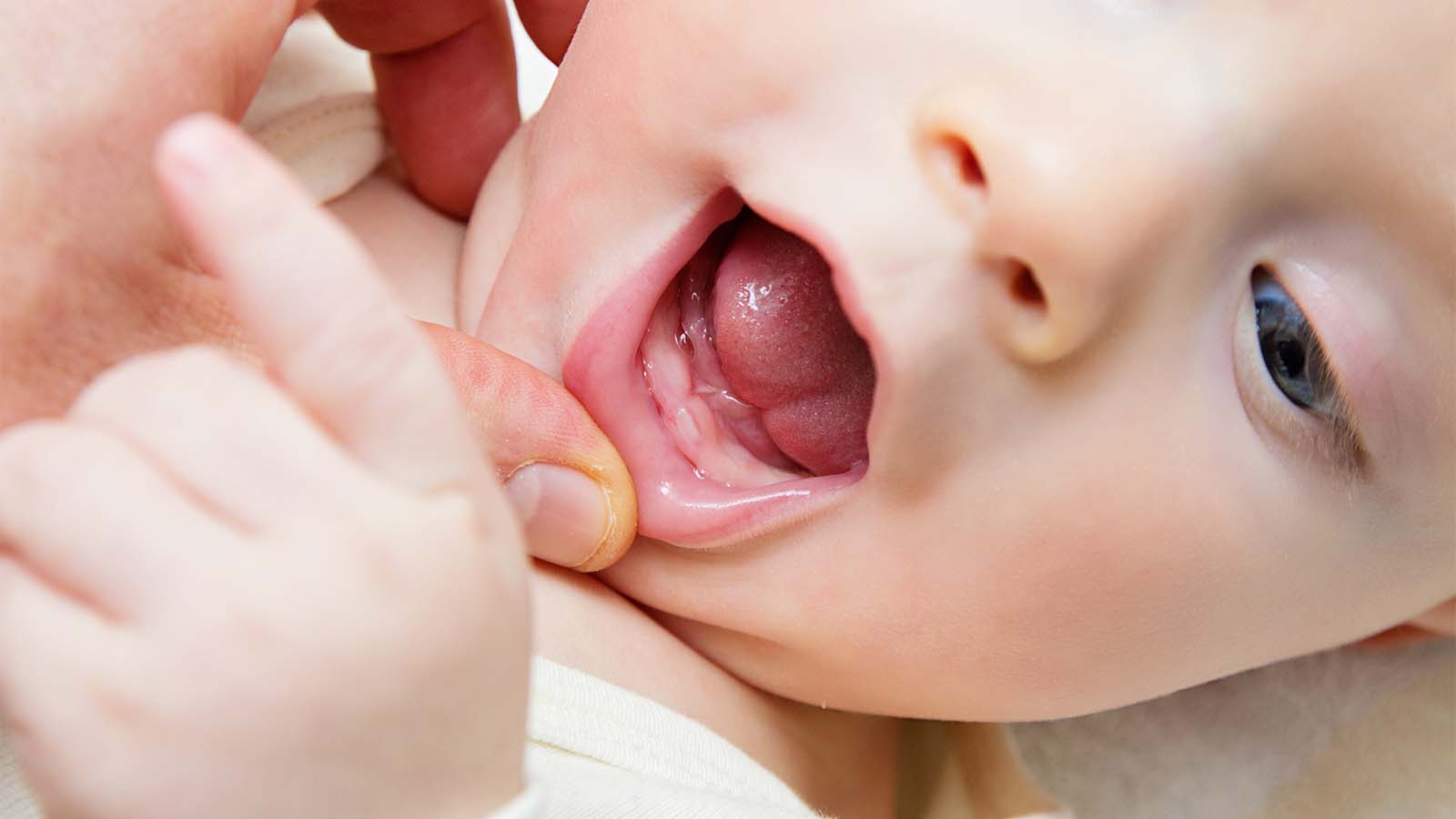 Стоматит и прорезывание зубов у ребенка